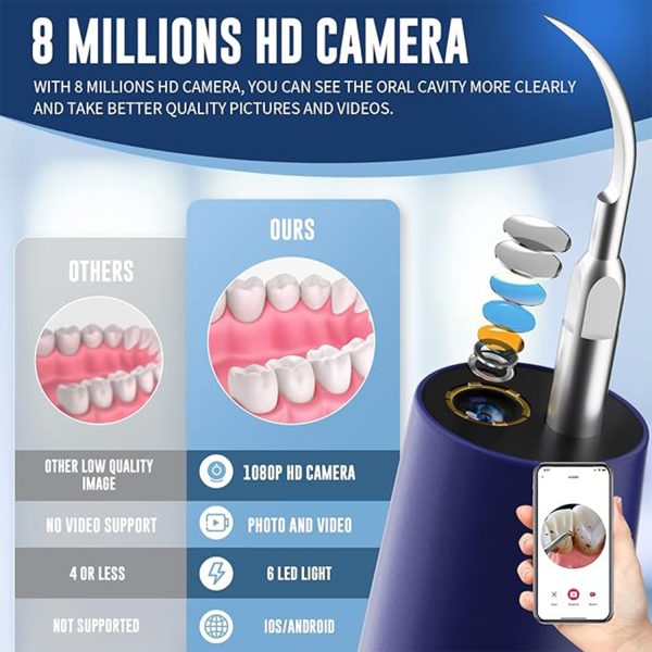 Plaque/Tartar Remover for Teethv